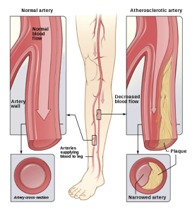 a diagram of pad